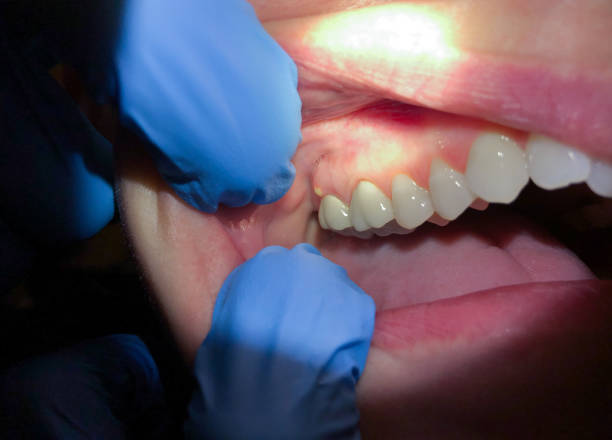 Best Emergency TMJ Treatment in Groveport, OH