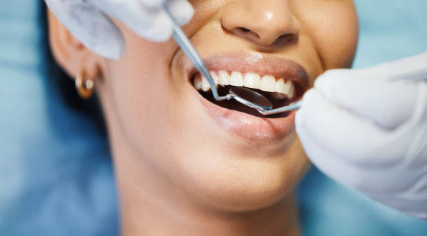 Best Cosmetic Emergency Dentistry in Groveport, OH