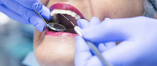 Best Emergency Dental Care for Broken or Chipped Teeth in Groveport, OH