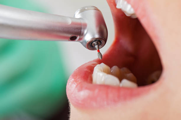 Best Emergency Dental Care for Broken or Chipped Teeth in Groveport, OH